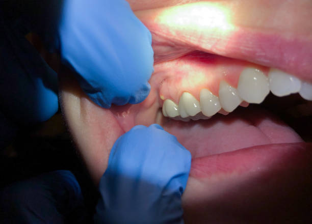 Best Urgent Dental Care  in Yates Center, KS
